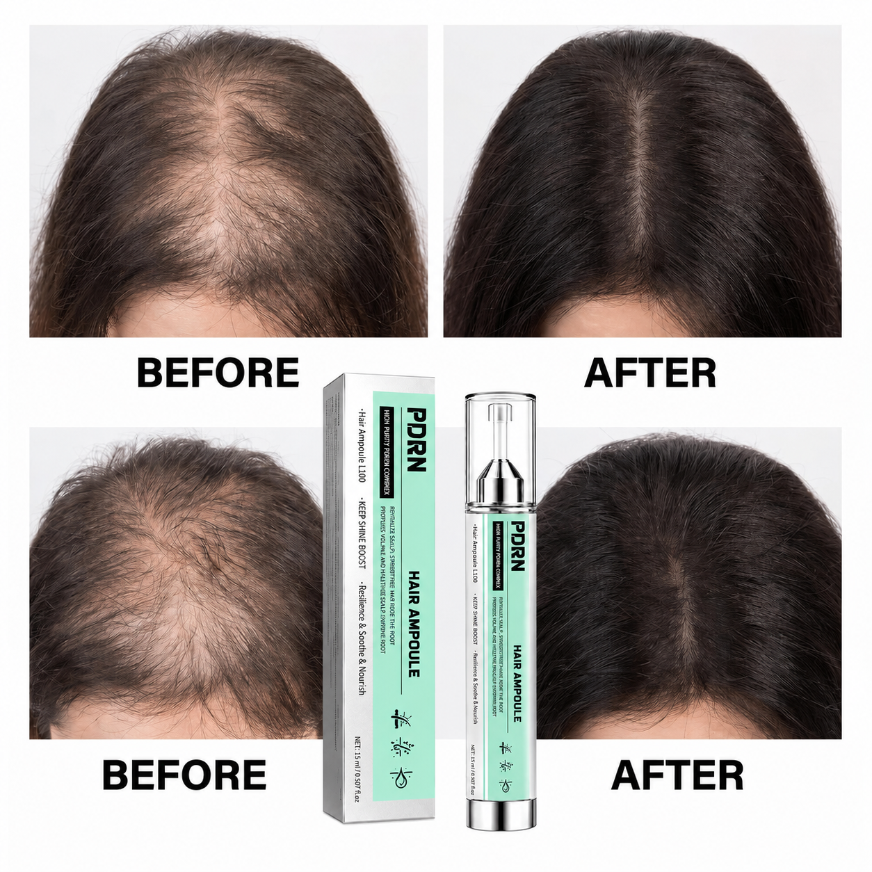 PDRN Hair Ampoule L100 – Lightweight Scalp & Root Serum for Fuller-Looking, Healthier-Shine Hair, Precision Application, 15 mL / 0.507 fl oz