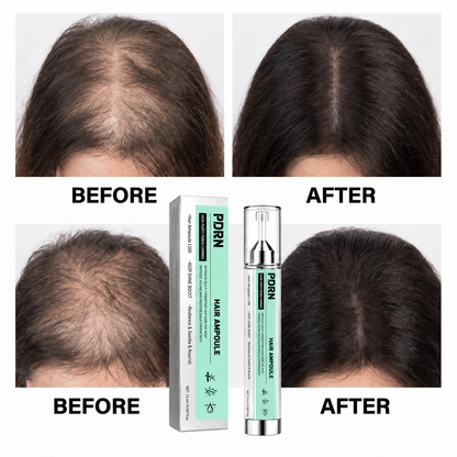 PDRN Hair Ampoule L100 – Lightweight Scalp & Root Serum for Fuller-Looking, Healthier-Shine Hair, Precision Application, 15 mL / 0.507 fl oz