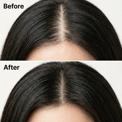 Korean Scalp Renewal Bar