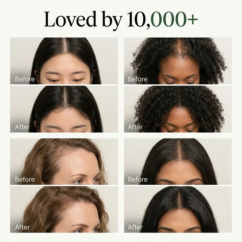 Korean Scalp Renewal Bar