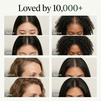Korean Scalp Renewal Bar